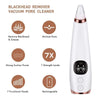 SearchFindOrder Blackhead Vacuum Pore Cleaner Beauty Tool