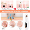 SearchFindOrder Blackhead Vacuum Pore Cleaner Beauty Tool