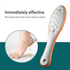 SearchFindOrder Professional Foot File & Callus Dead Skin Remover